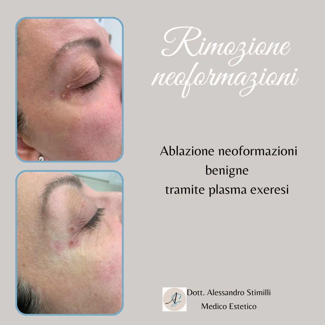 Alessandro Stimilli-17