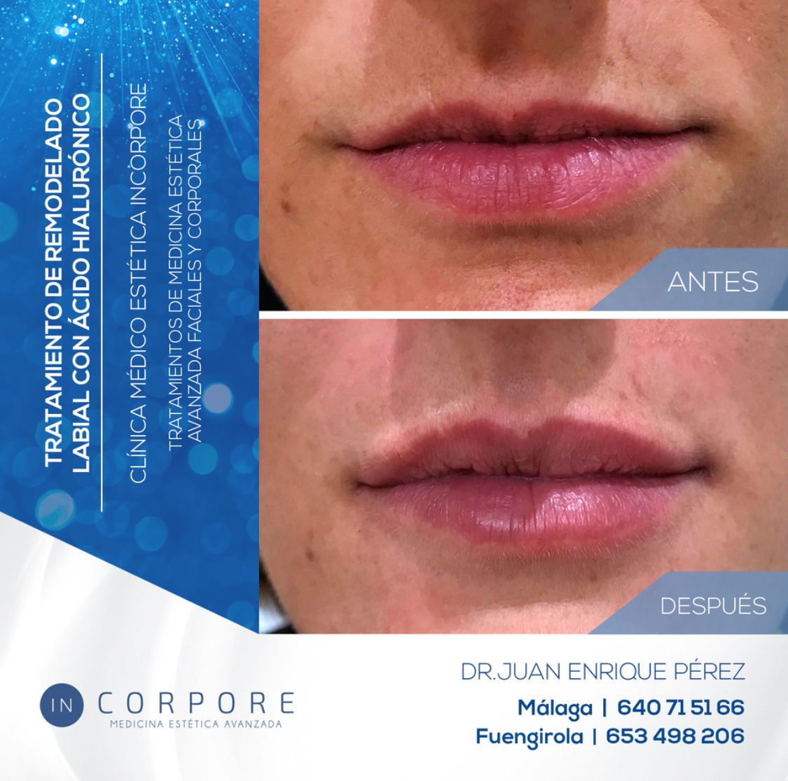 Juan Enrique Pérez Enríquez-102