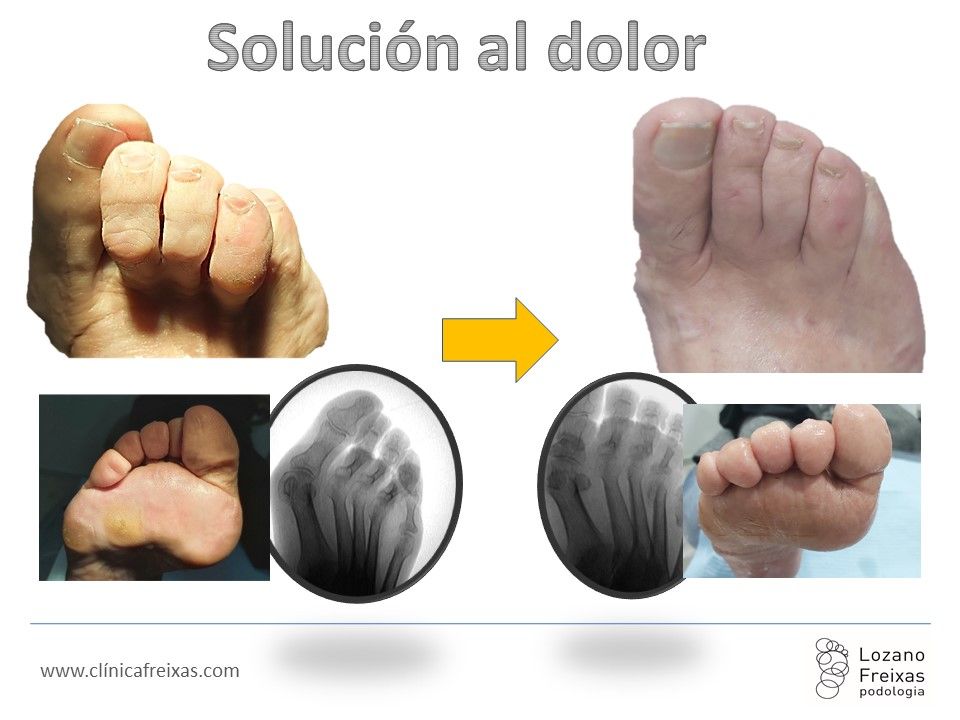 Joan Lozano Freixas-16