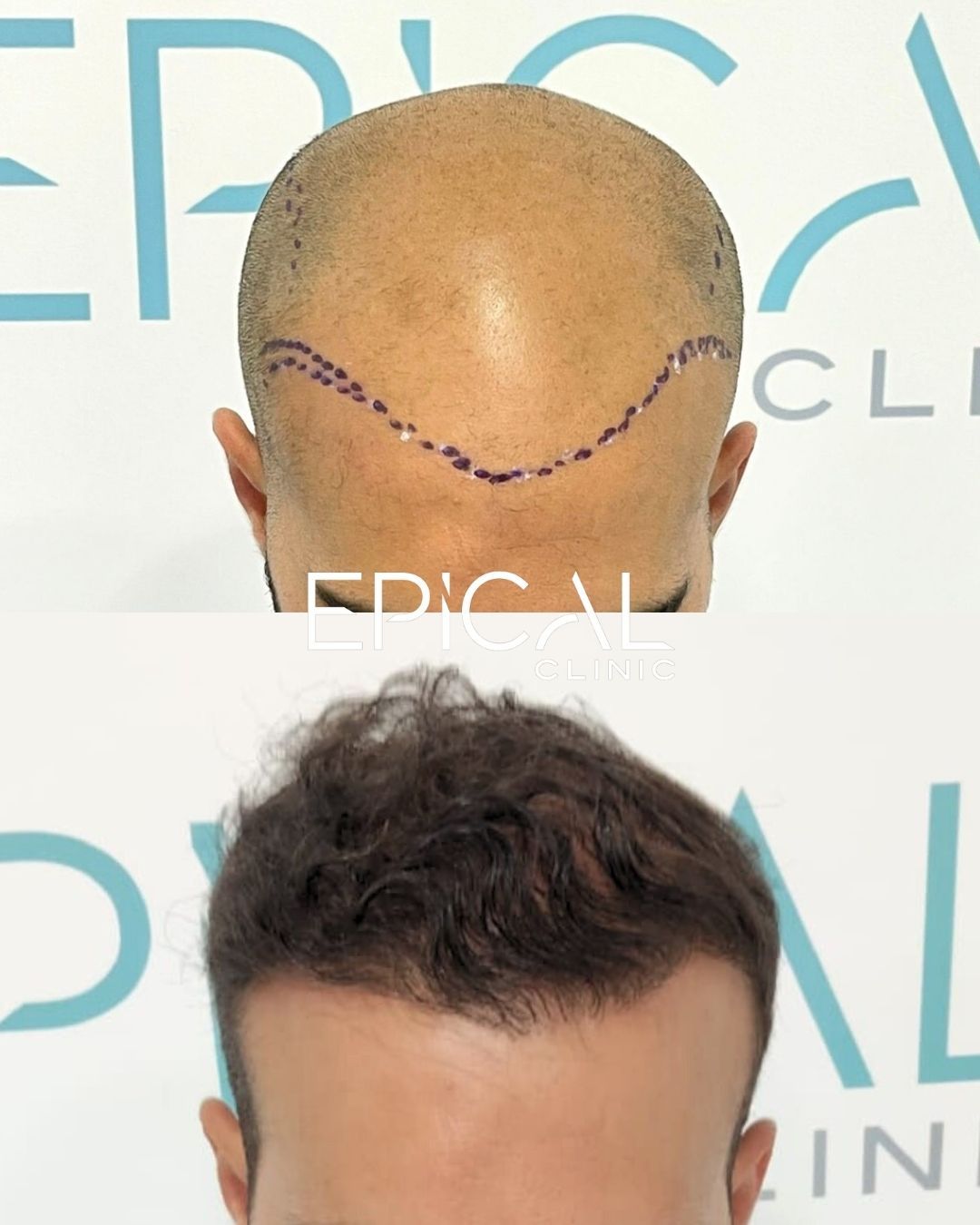 Juan Francisco Belén Montero-10