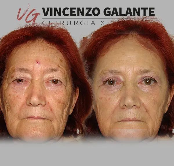 Vincenzo Galante-1