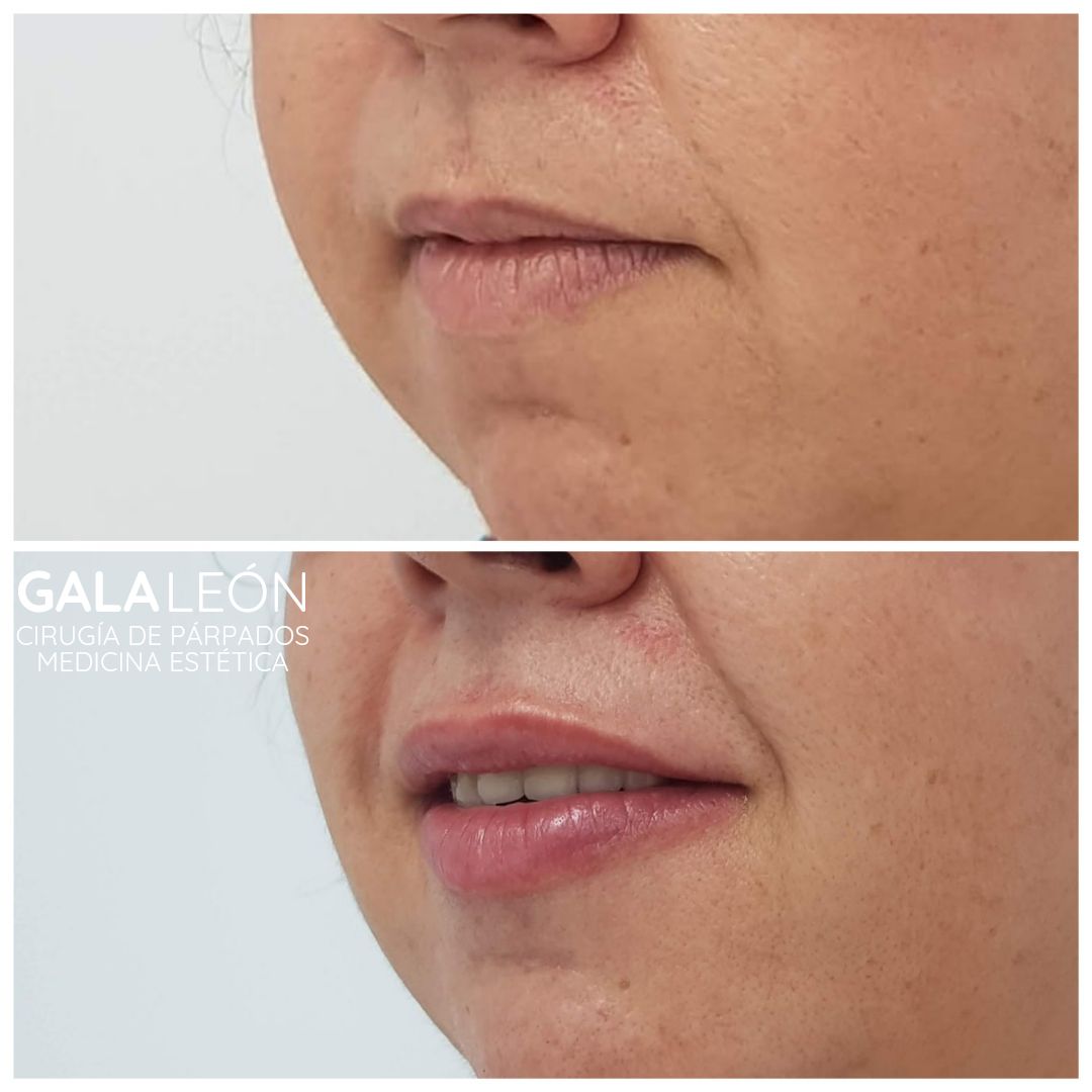 Gala P. Leon Salvatierra-29