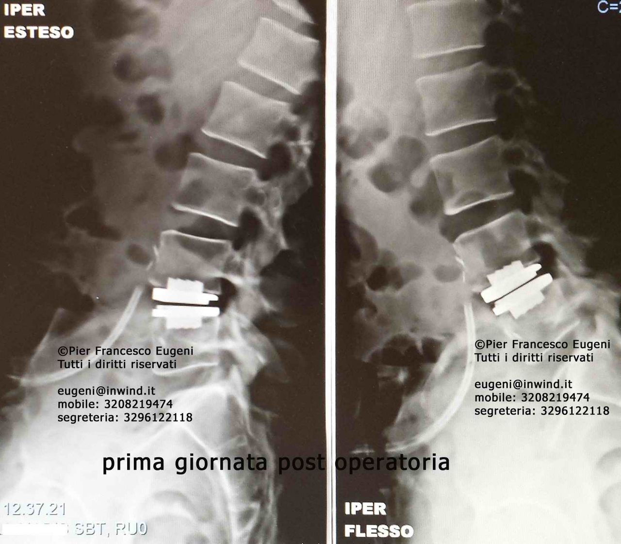 Pier Francesco Eugeni-7