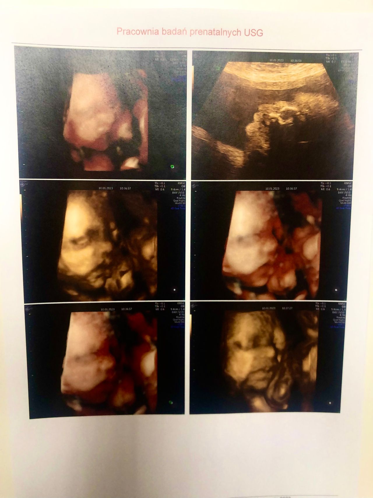 Wioletta Rozmus-Warcholińska-25