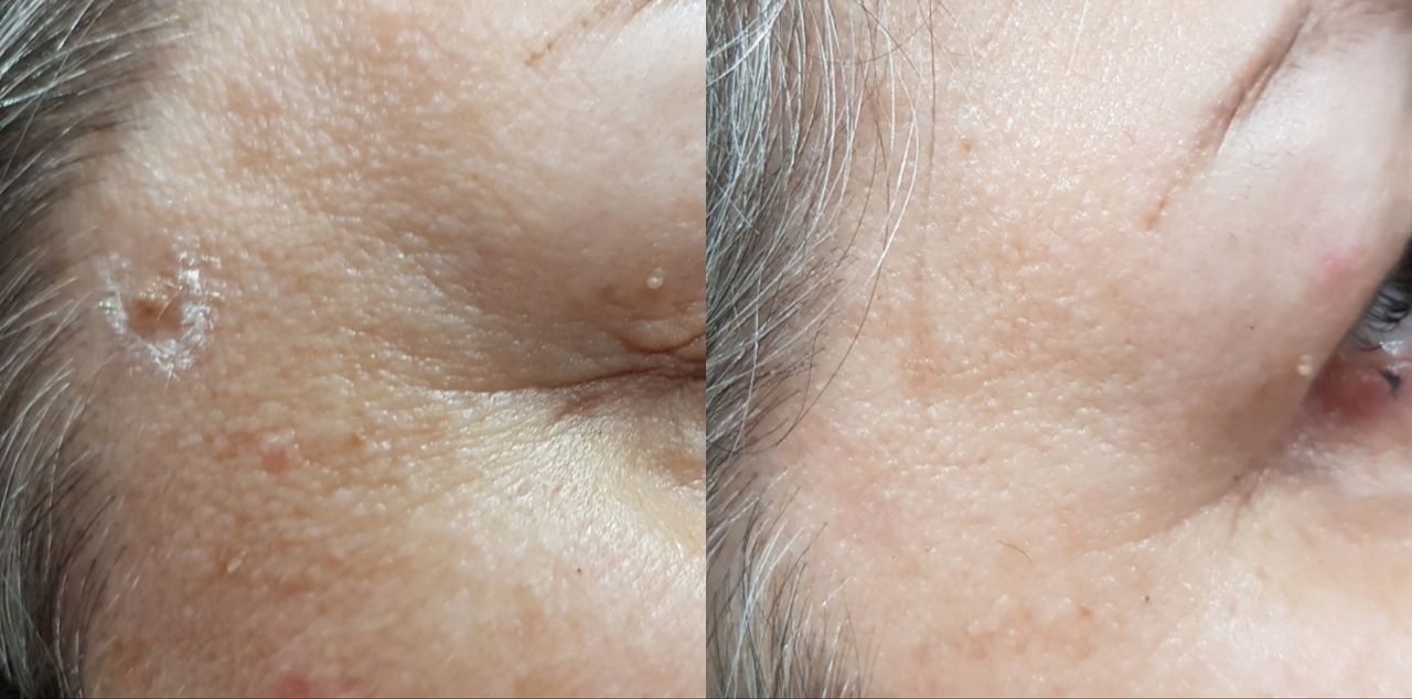 Rosalba Herrero Zerpa-221