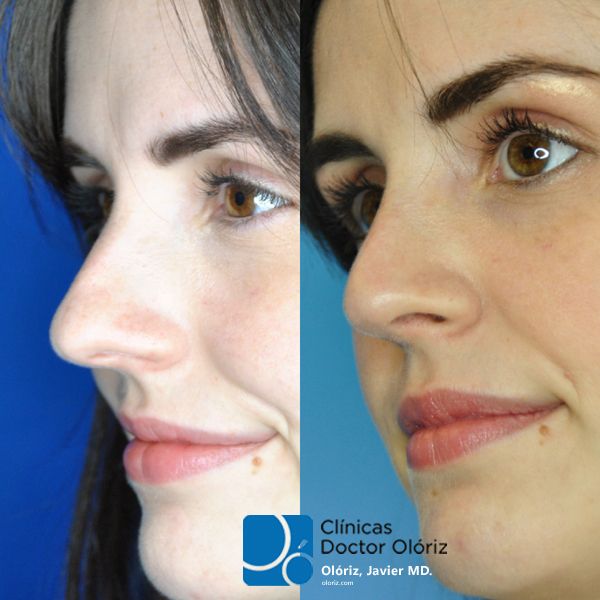 Javier Oloriz Marin-16