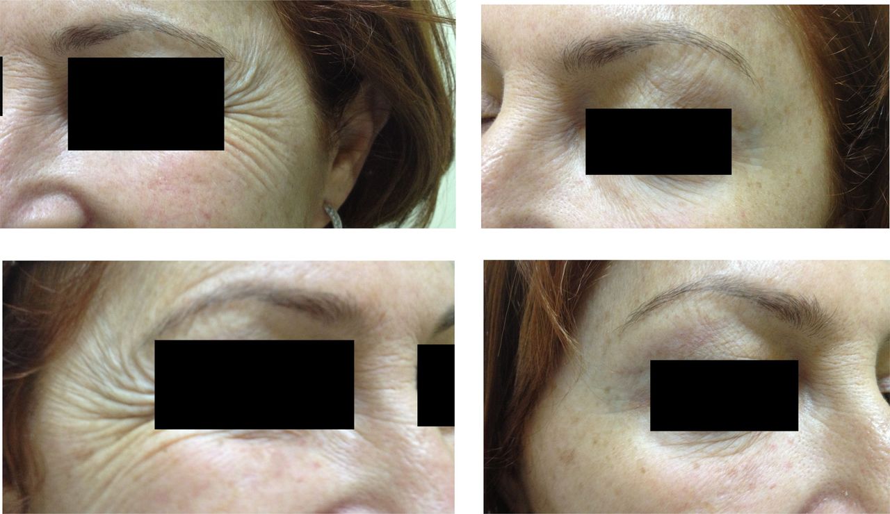 Virginia Cristina Rapisarda-31