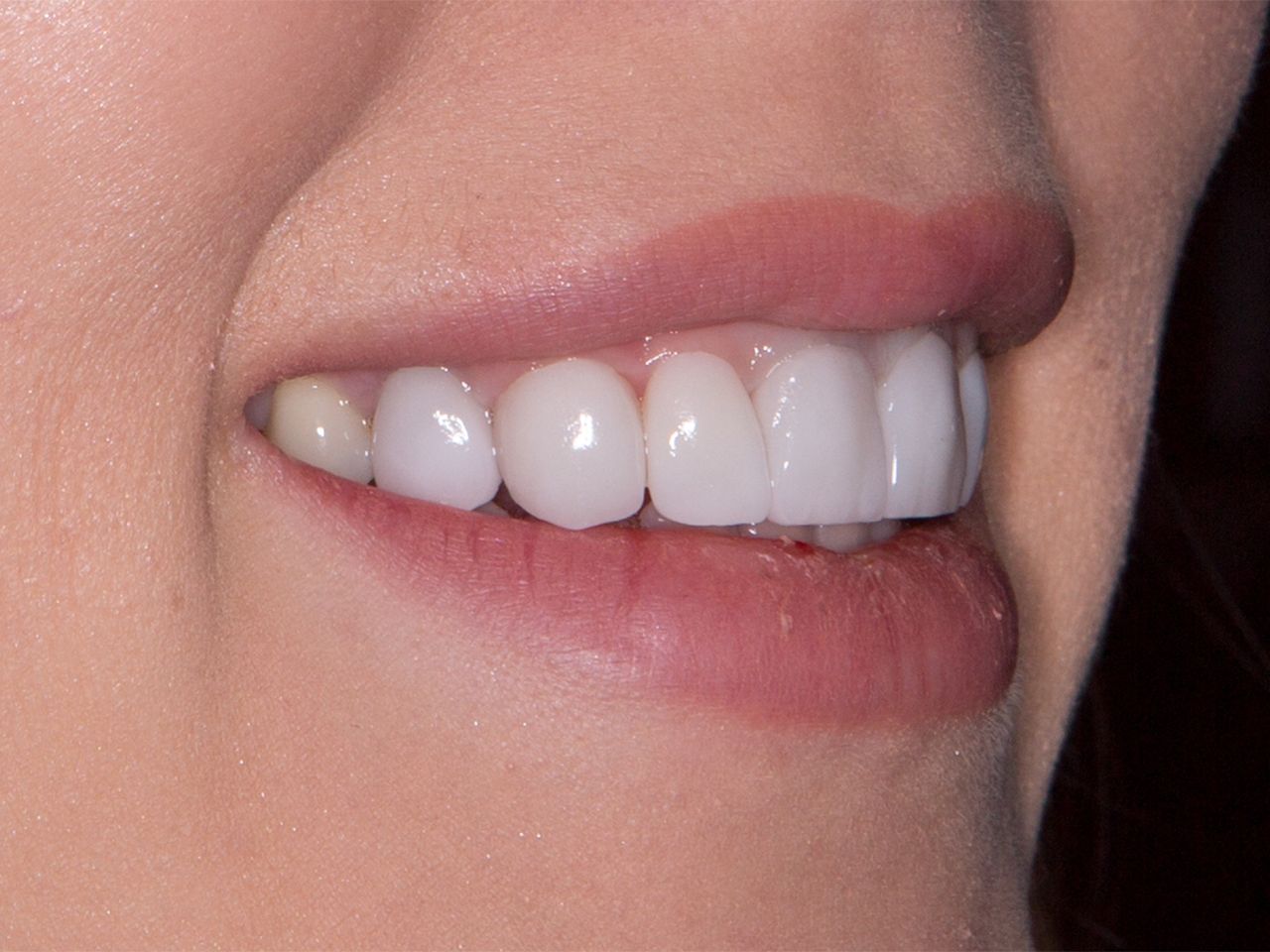 Francesco D'orazio-1