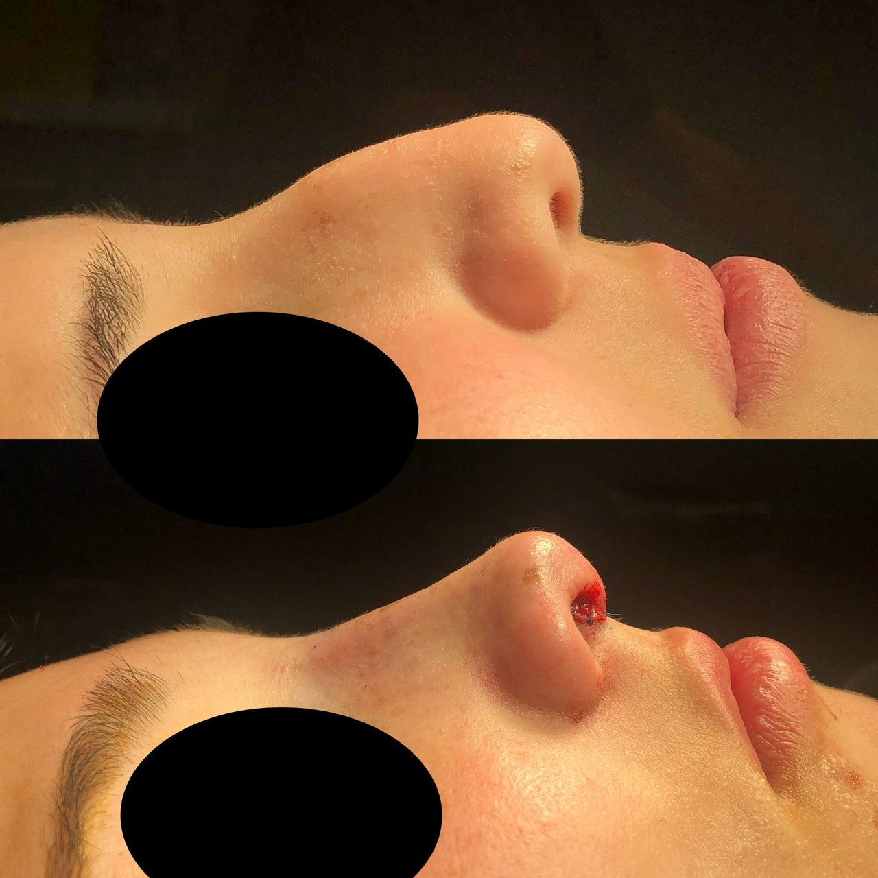 Alberto Candau Álvarez-35