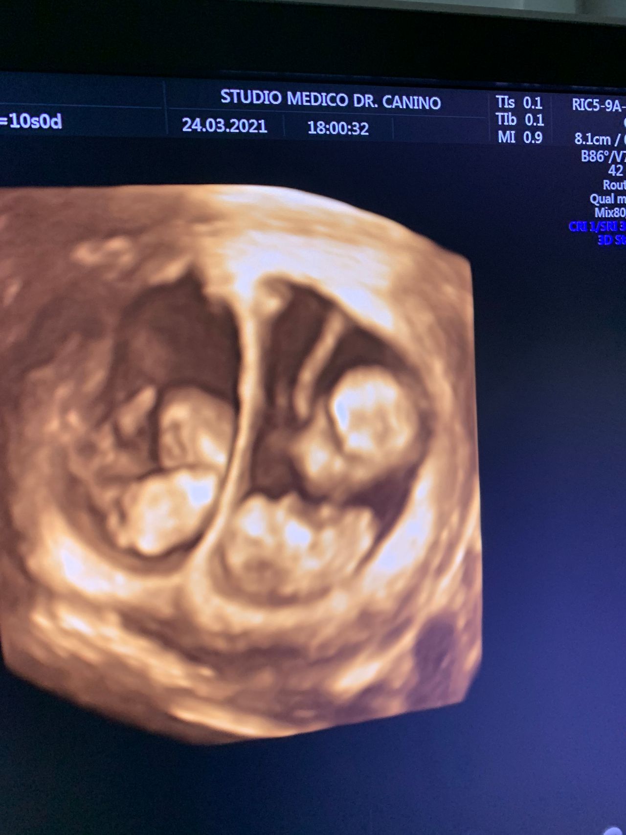 Francesco Antonio Bisogni-2