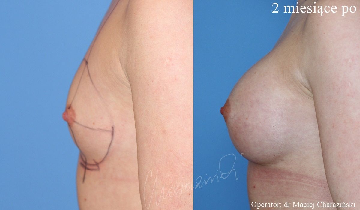 Maciej Charaziński-95