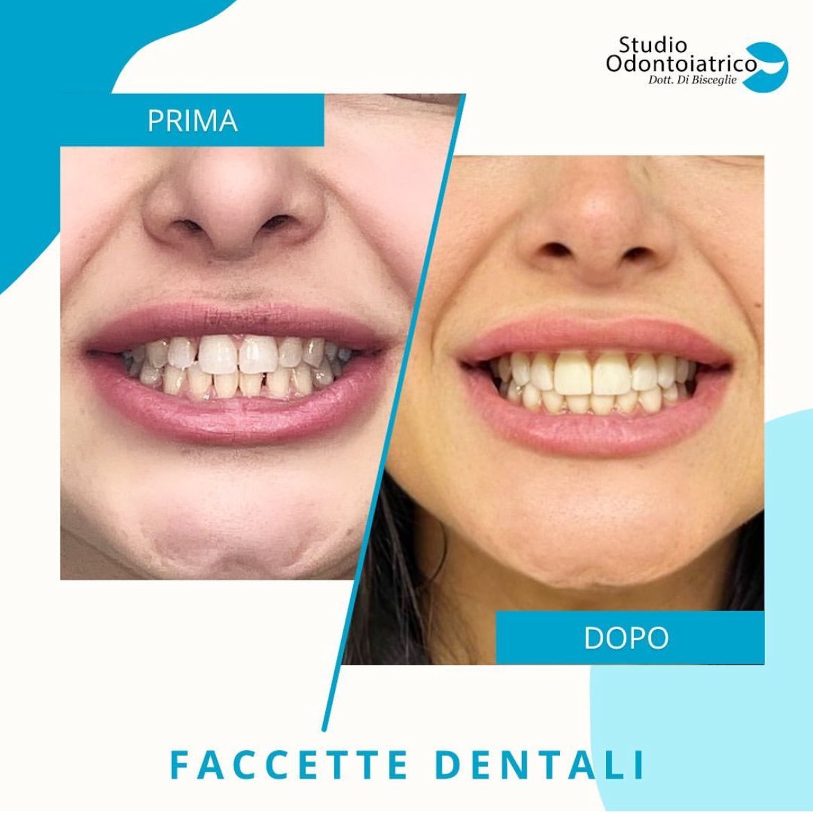 Matteo Di Bisceglie-8