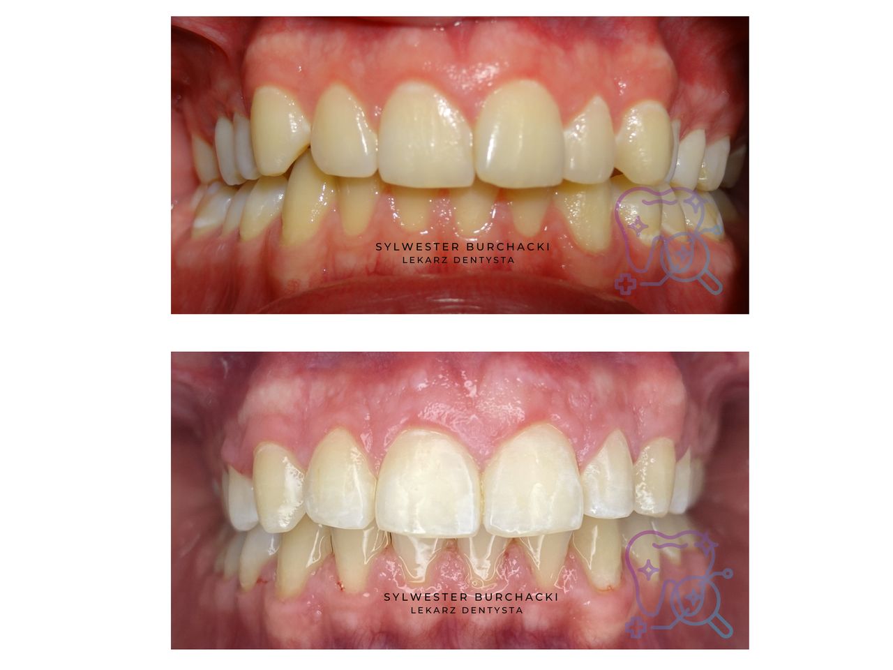 Sylwester Burchacki-3