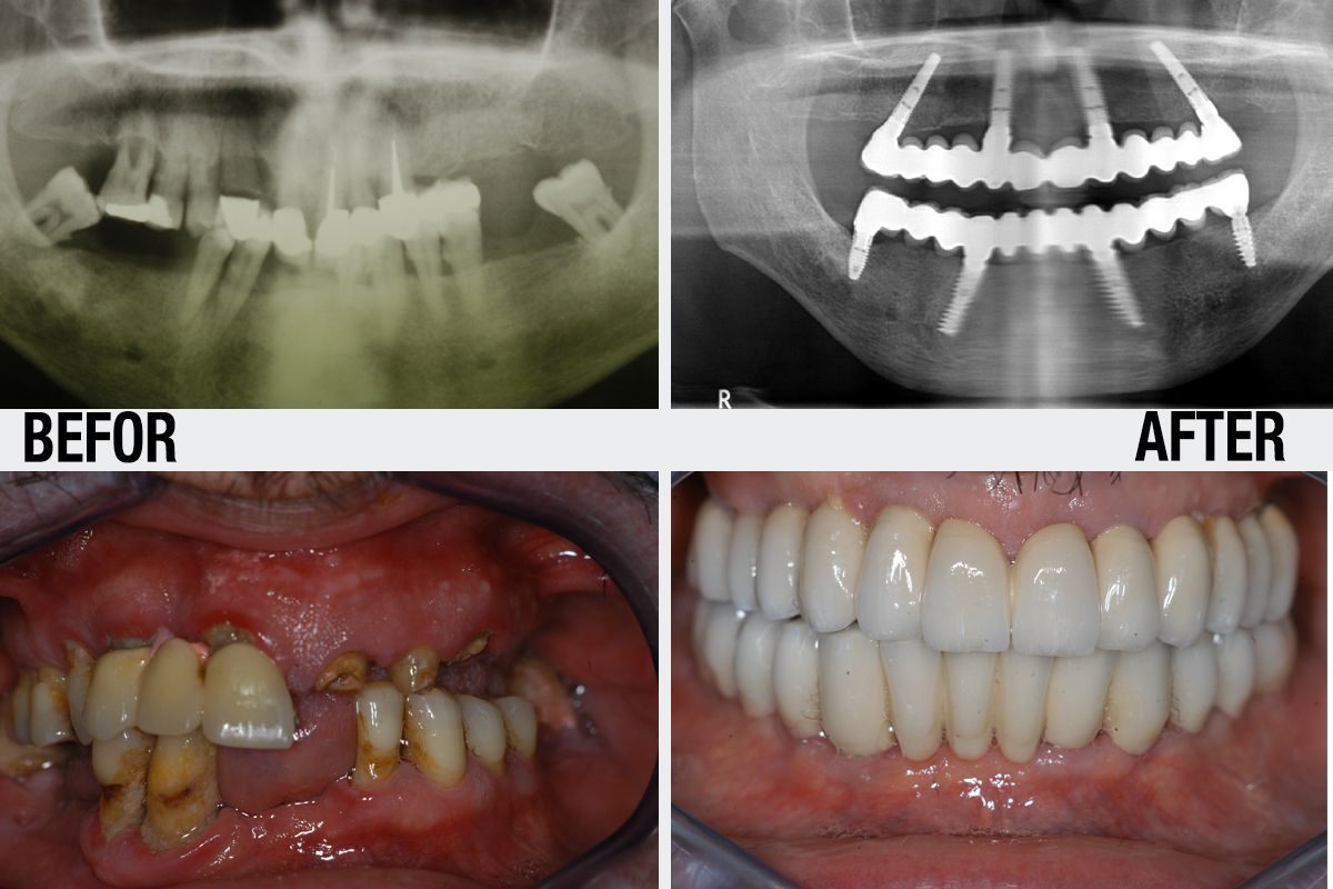 Alessandro Palumbo-33