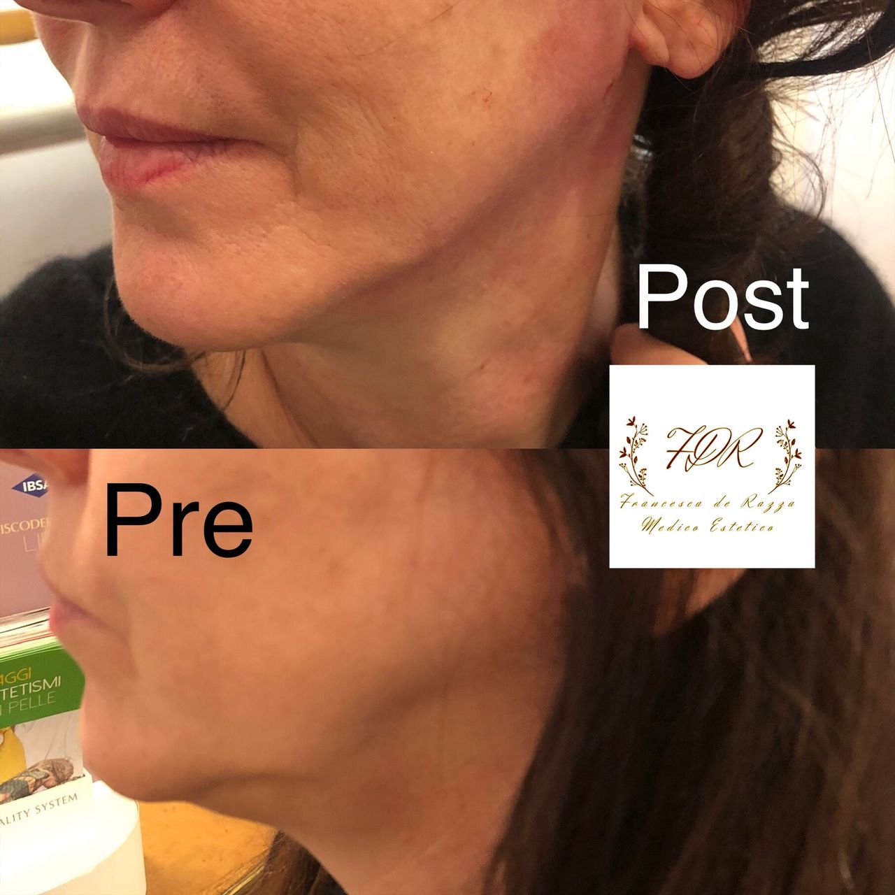 Francesca De Razza-33