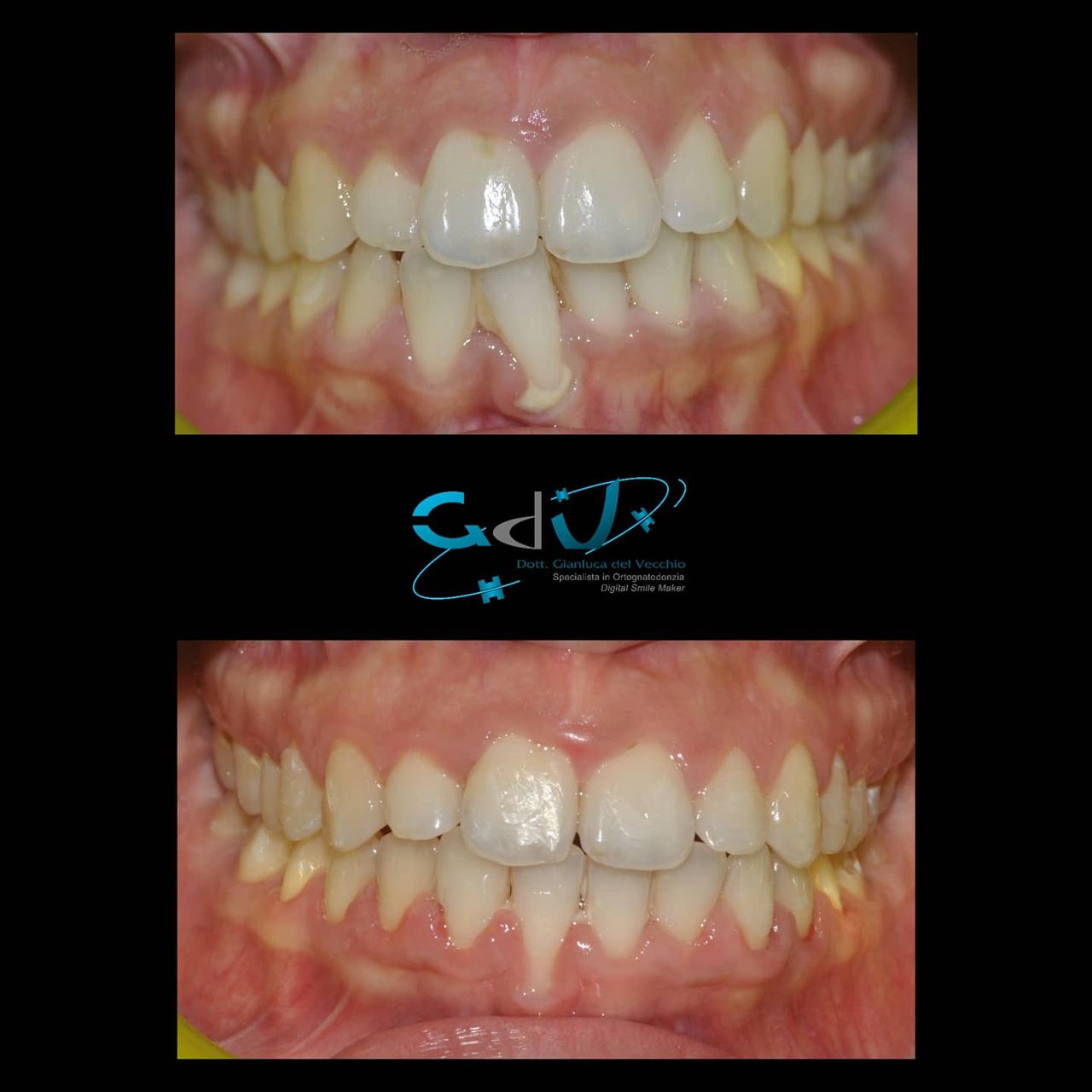 Gianluca Del Vecchio-114