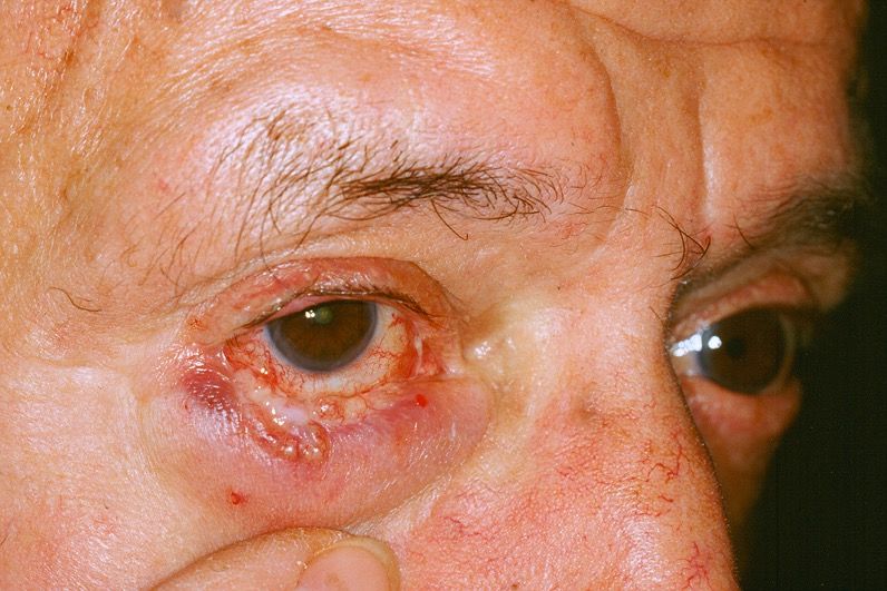 Franco Buttafarro-21