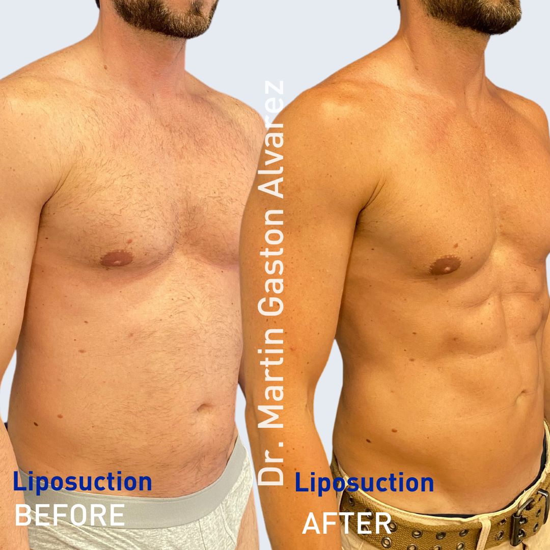 Martín Gastón Alvarez-7