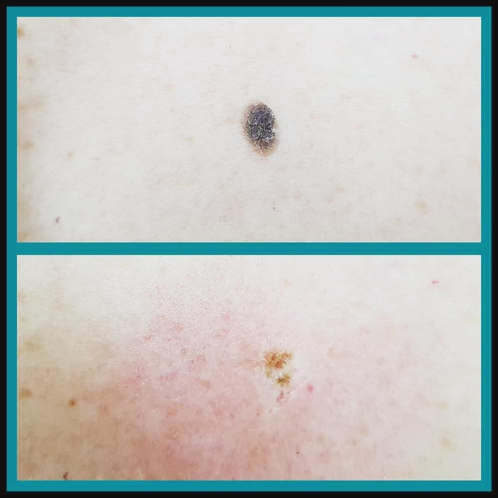 Rosalba Herrero Zerpa-362