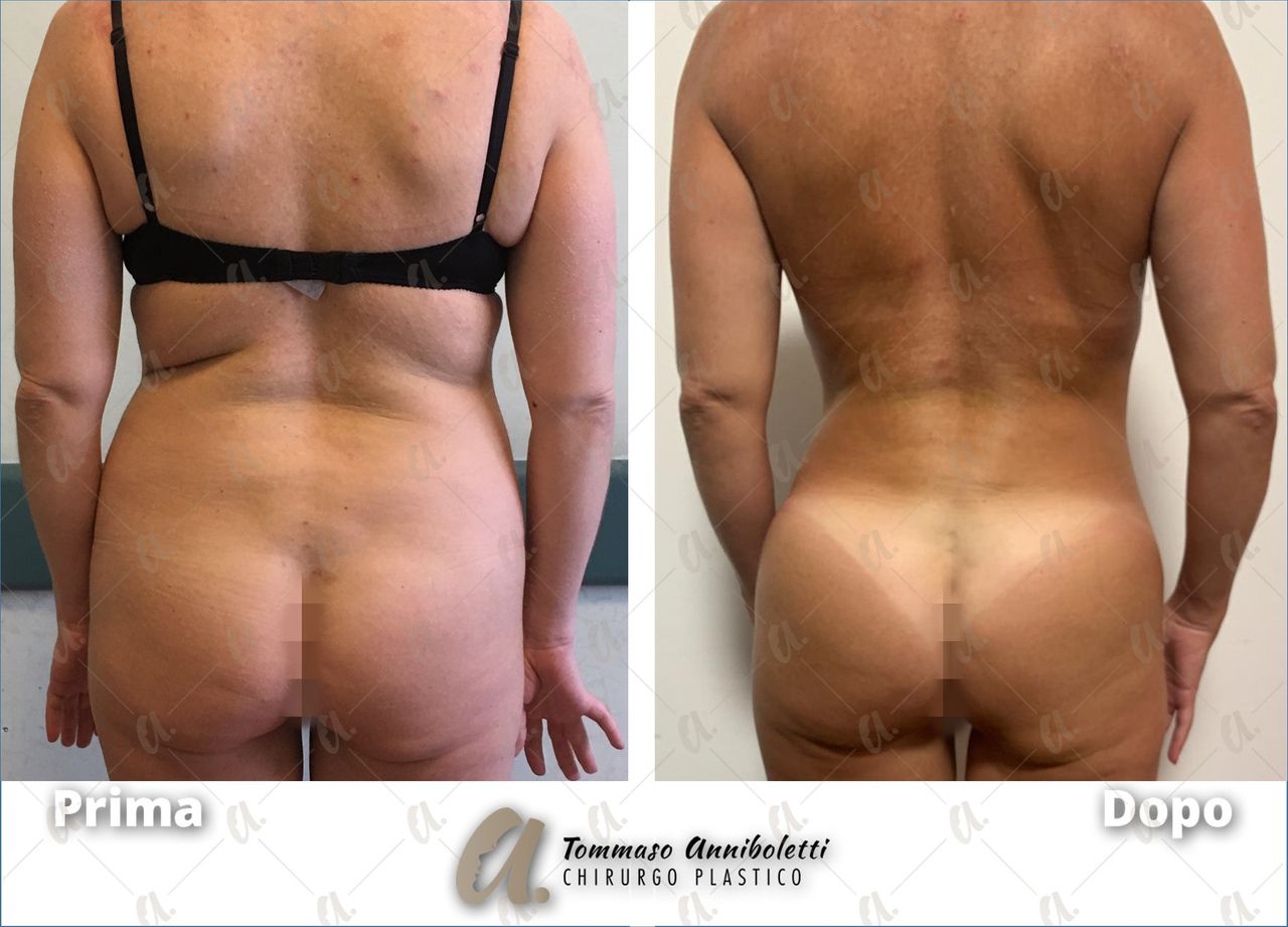 Tommaso Anniboletti-32