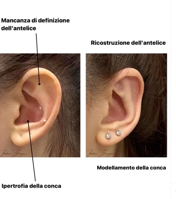 Federico Giorgini-10