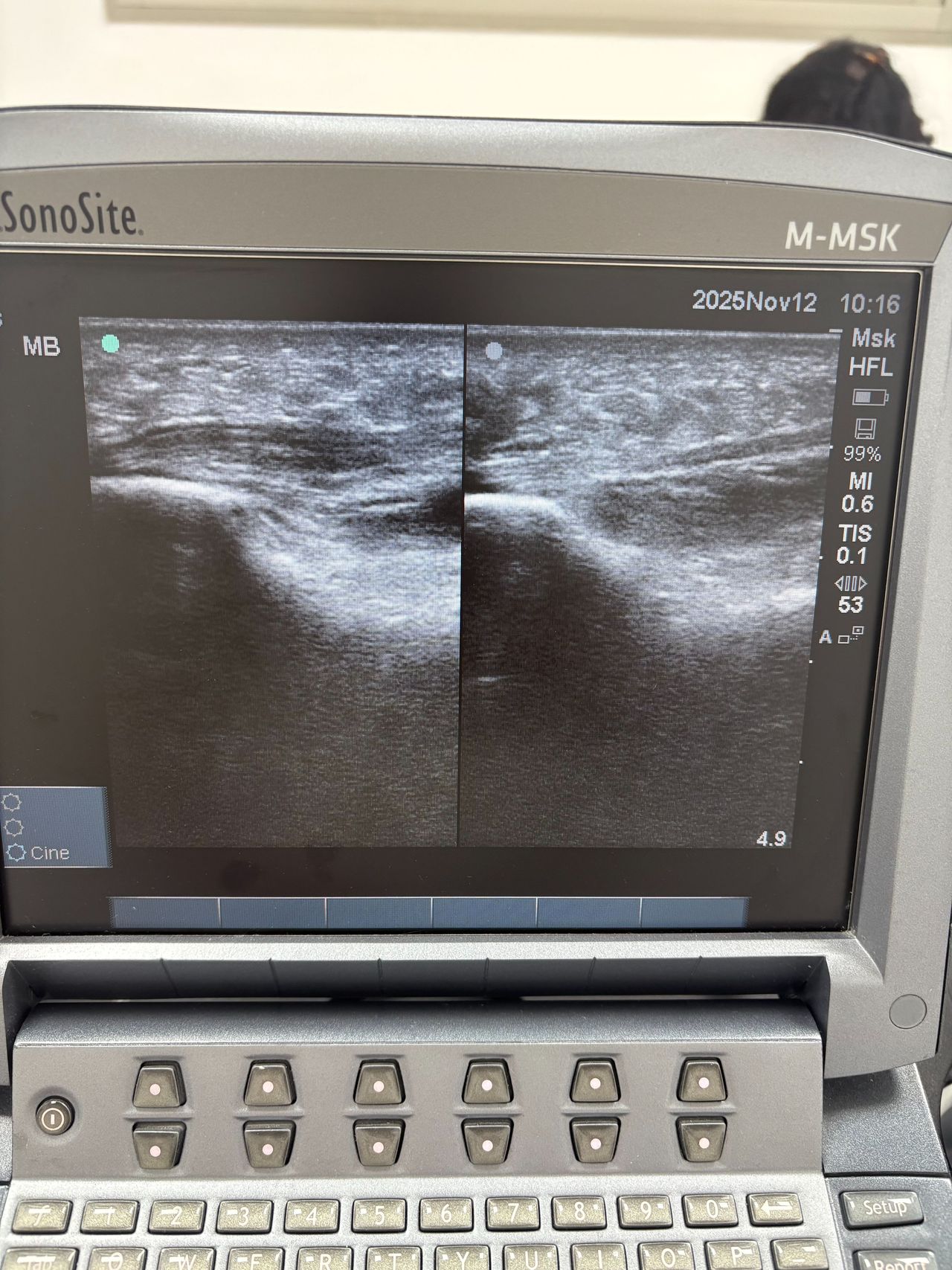 Sergio Buzón Barea-1