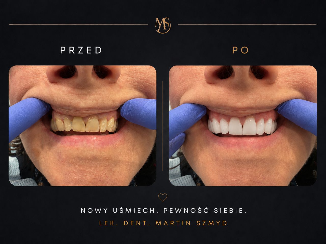 Martin Szmyd-0