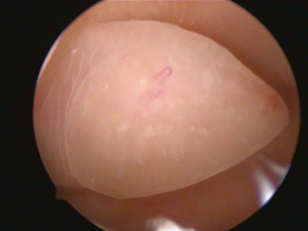 Francesco Paolo Improda-0