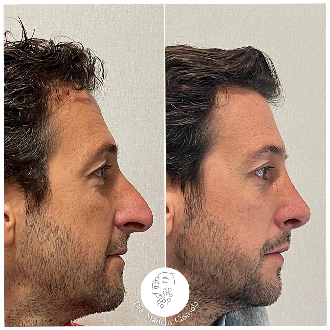 Sandra Marleny Casasola Girón-2