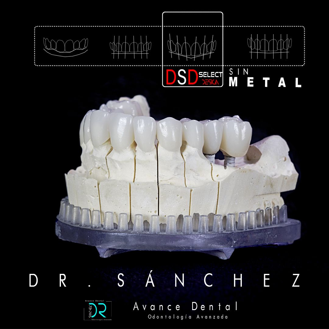 Juan Carlos Sánchez Pérez-13