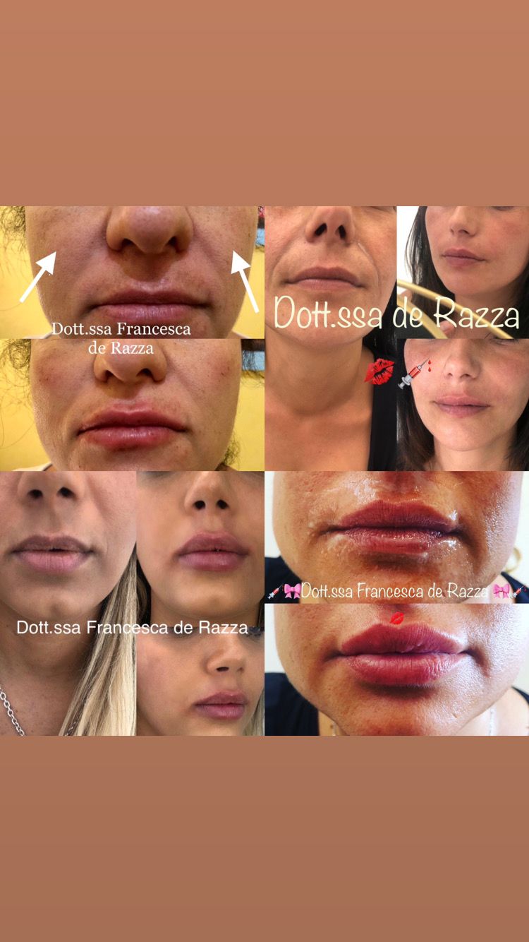 Francesca De Razza-24