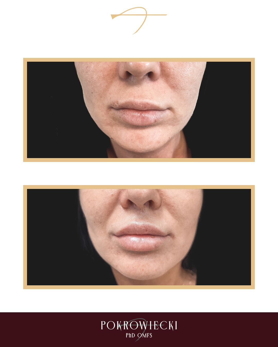 Rafał Pokrowiecki-10