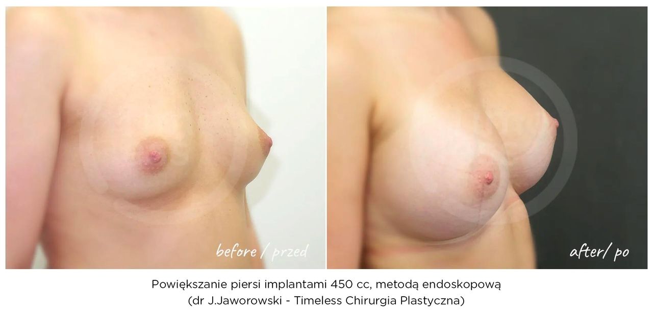 Janusz Jaworowski-101