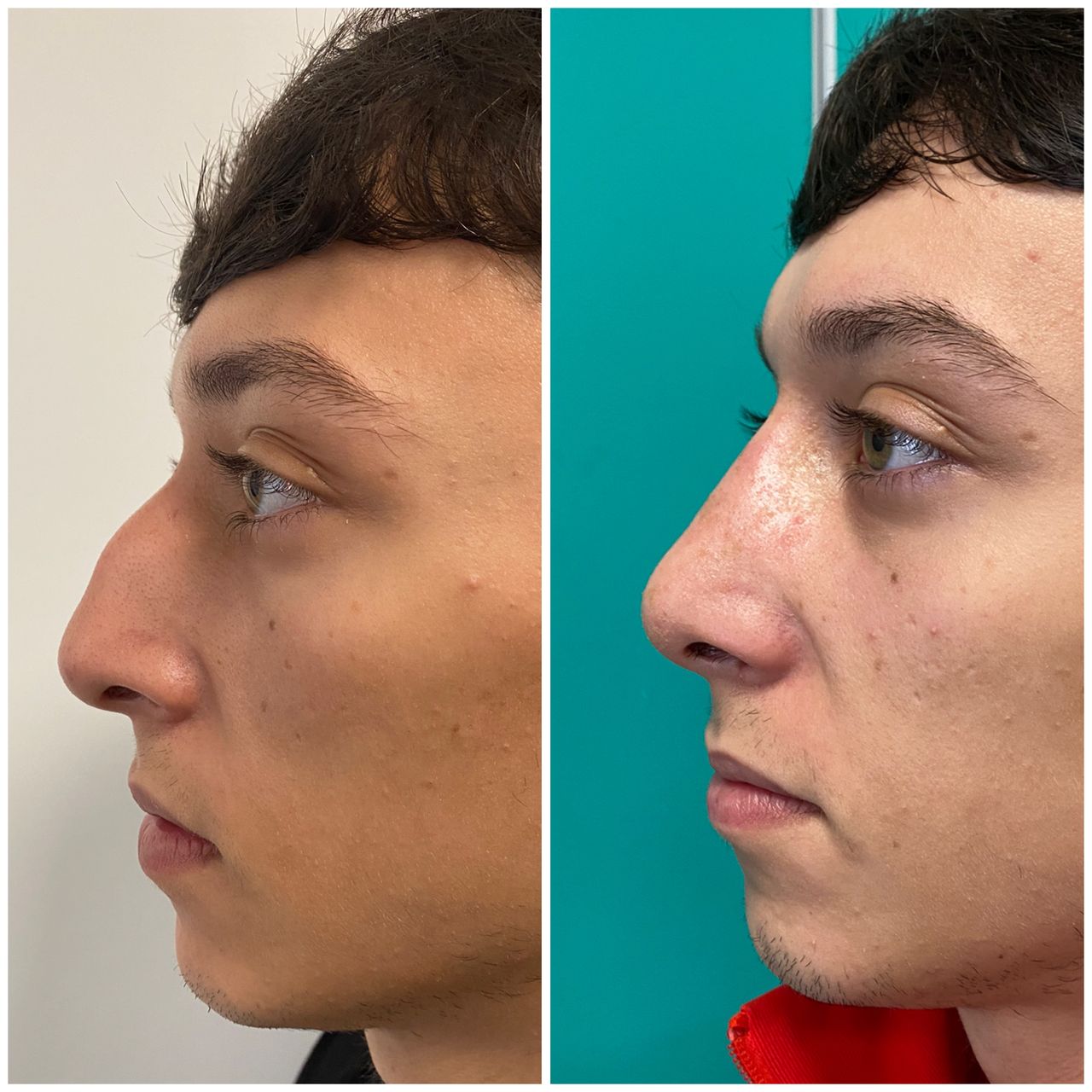 Maurizio Perugini-19