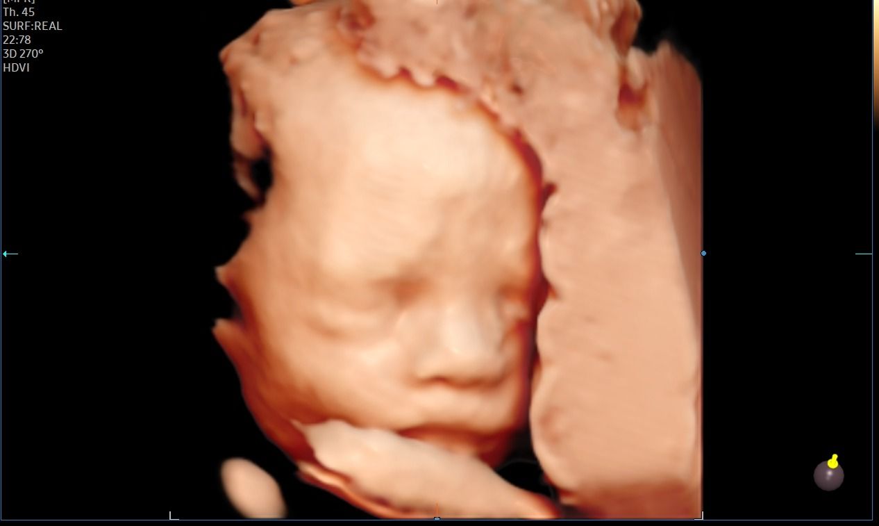 Martina Bartolone-10