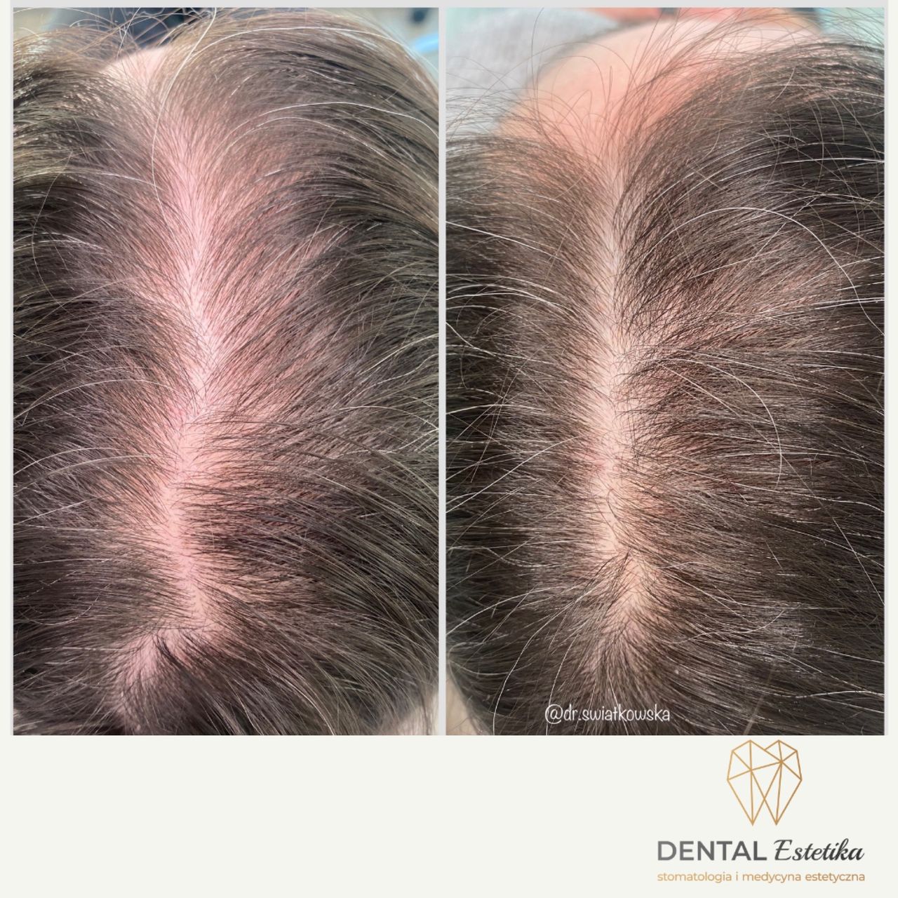 Angelika Świątkowska-42