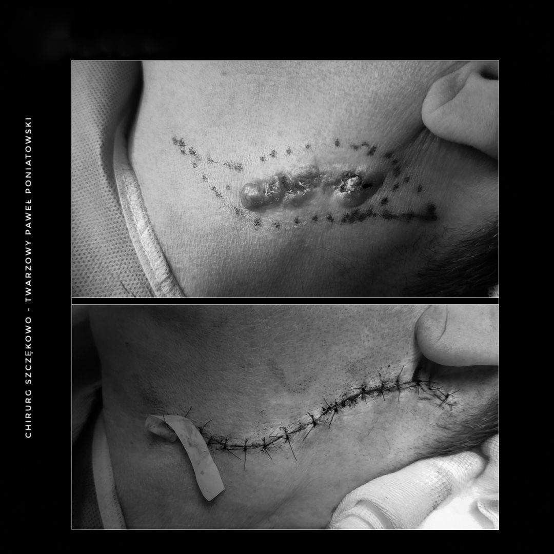 Paweł Poniatowski-8