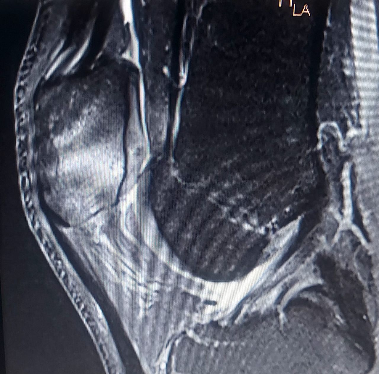 Álvaro Cerezuela Sánchez-11