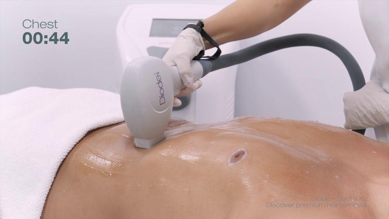 José Luis López Estebaranz-29