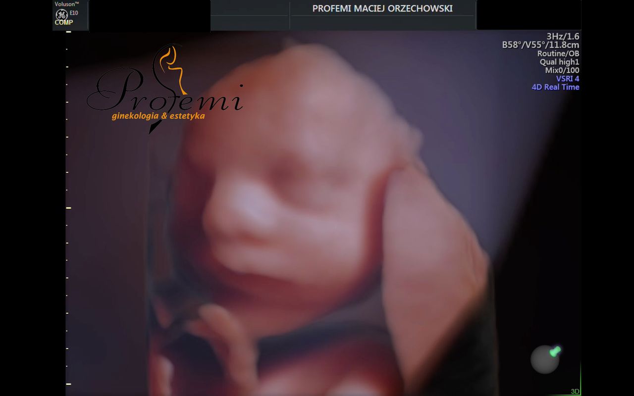 Maciej Orzechowski-24