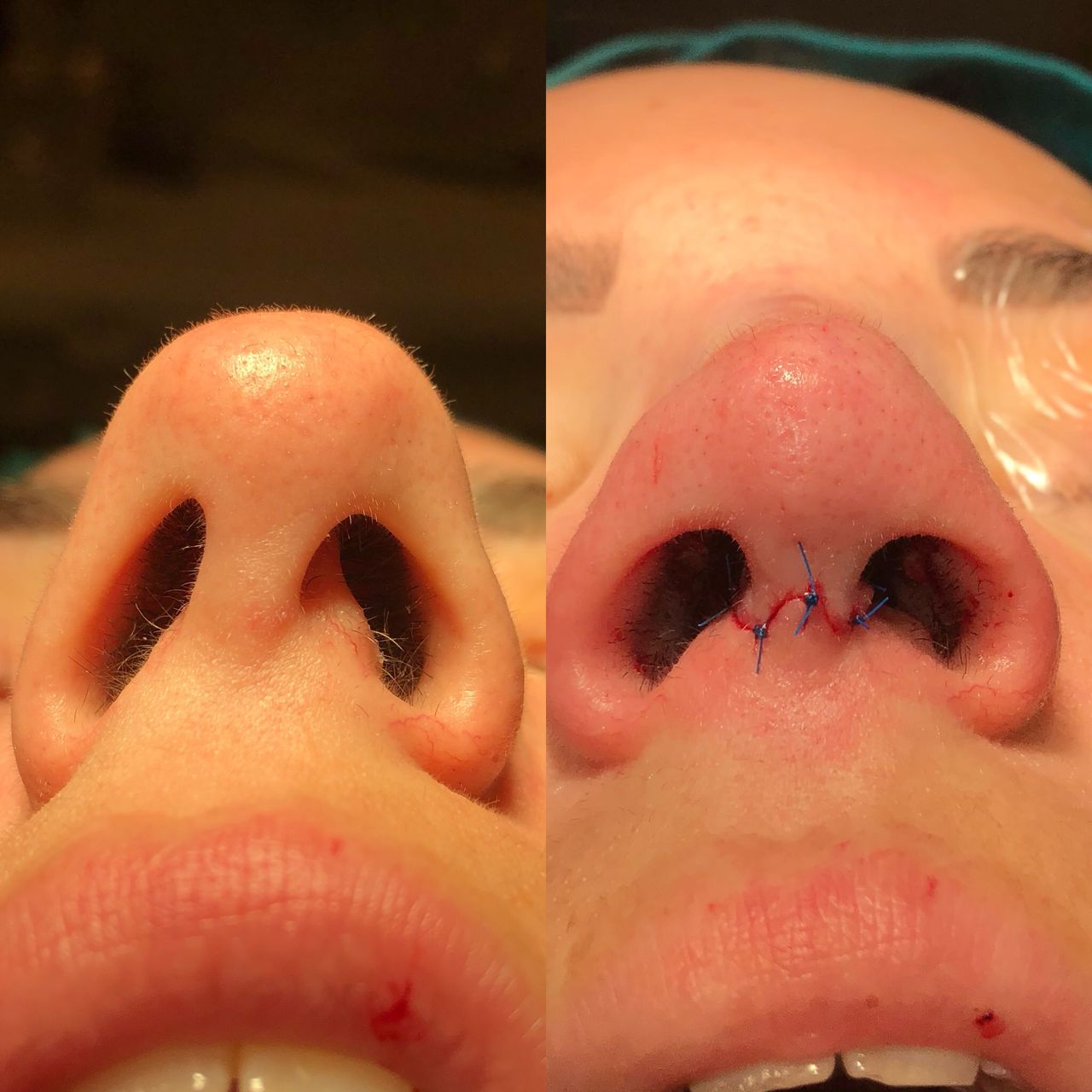 Alberto Candau Álvarez-23