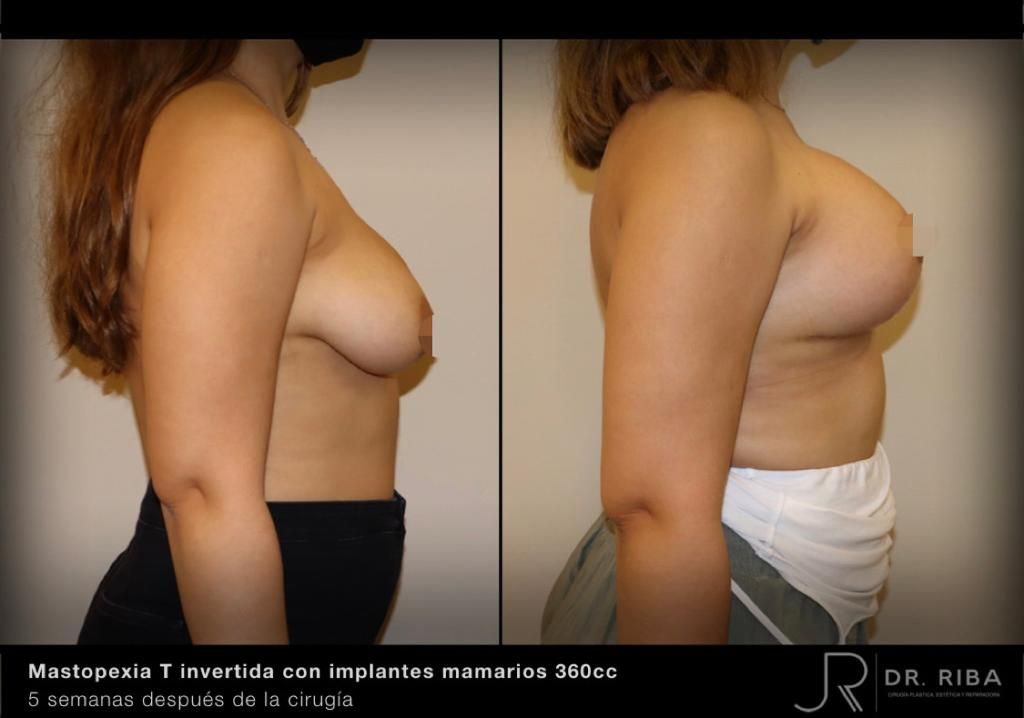 Jordi Riba Vilchez-50