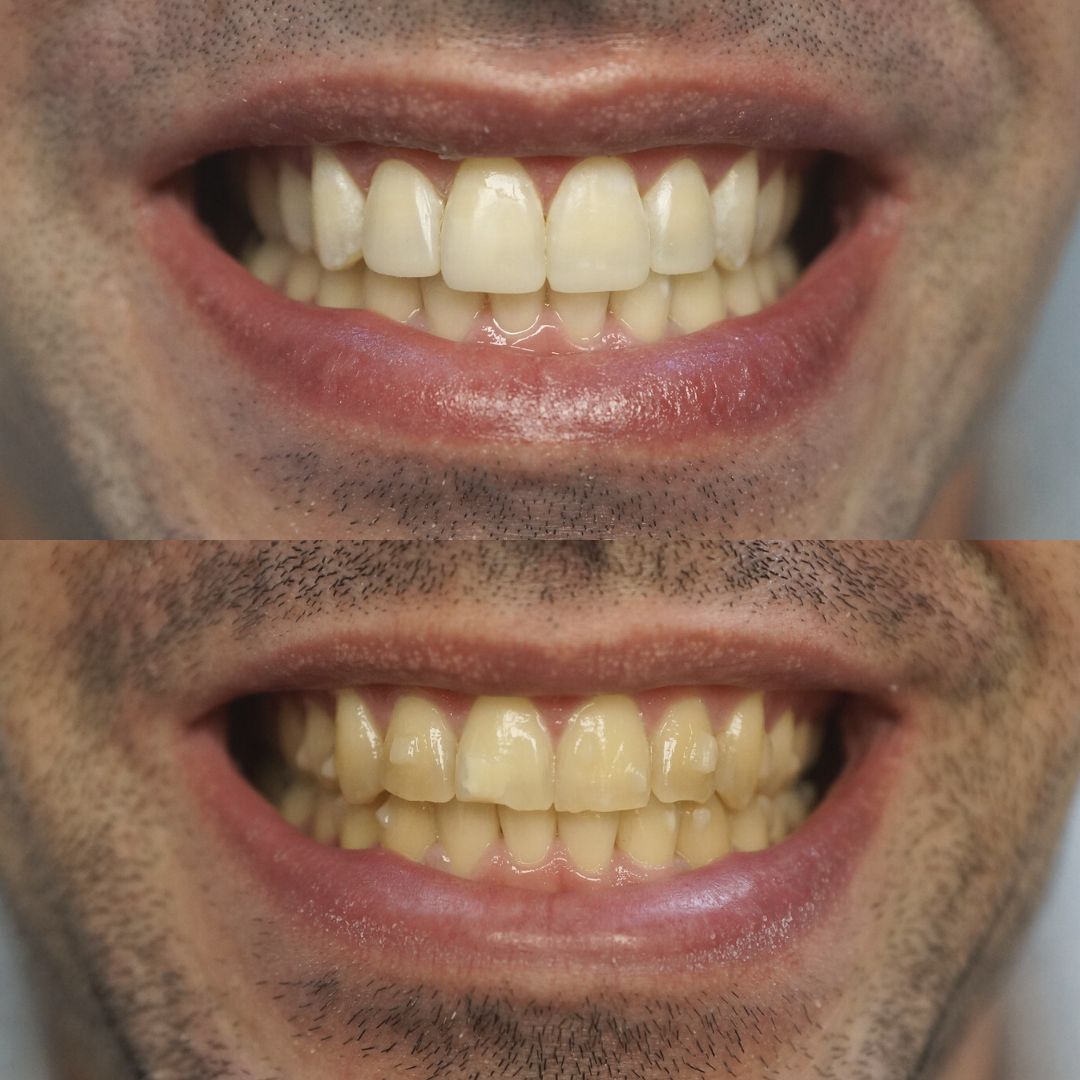 Raimonda Bogdanoviciute-25