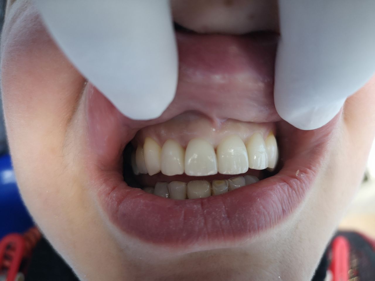 Stefano De Simone-76