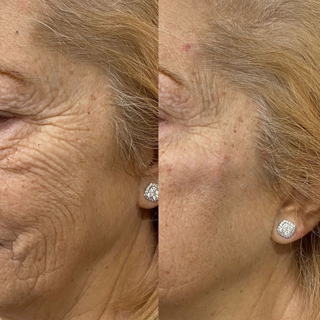 Illiana Cabrera Ortiz-8