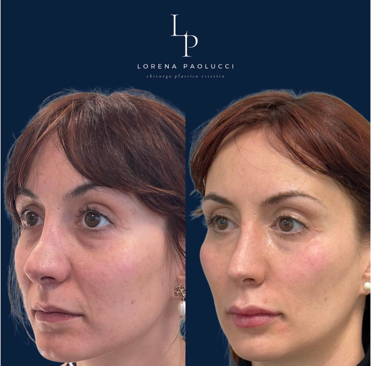 Lorena Paolucci-29