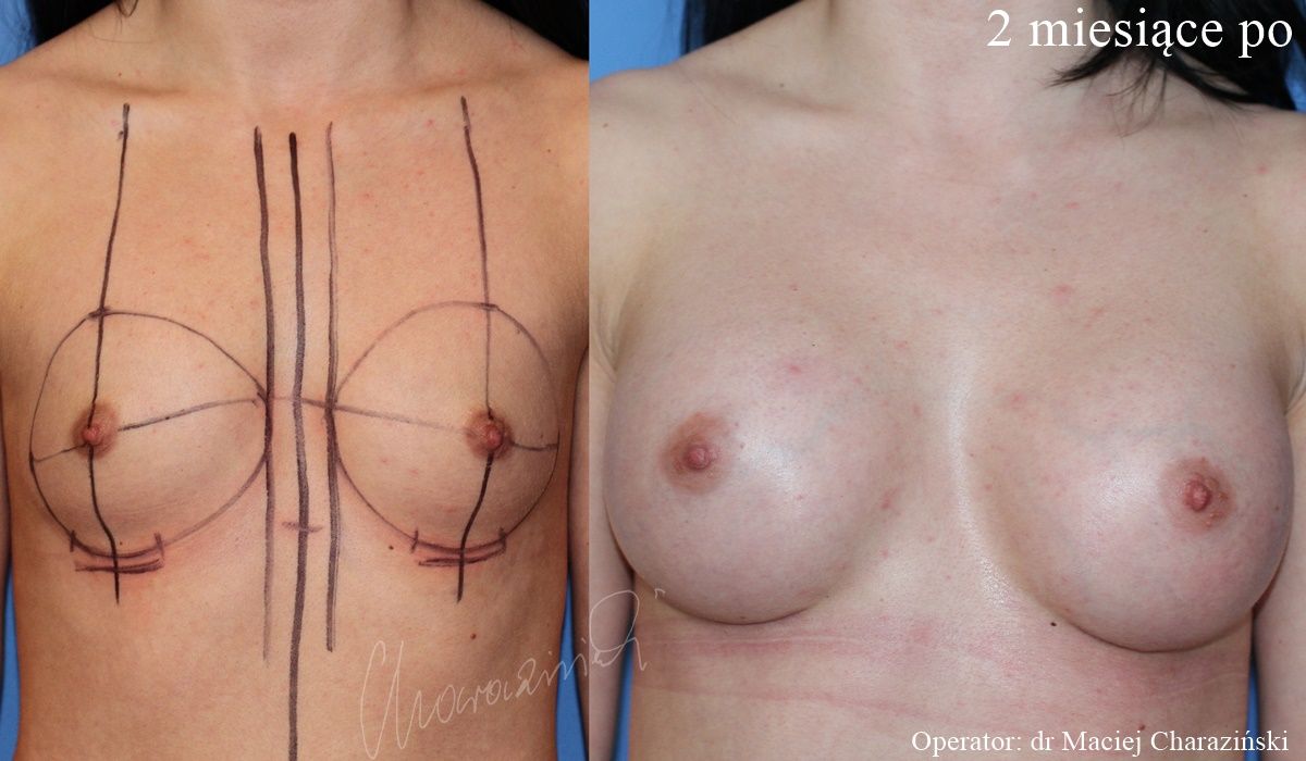 Maciej Charaziński-98