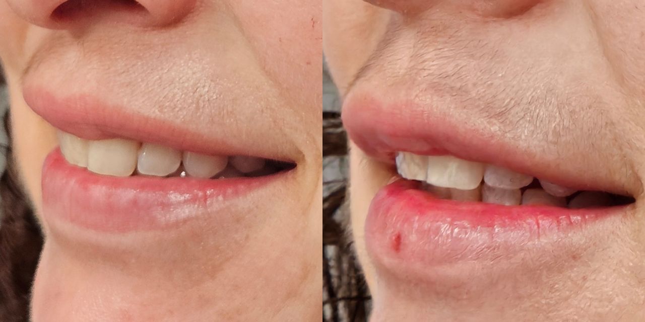 Rosalba Herrero Zerpa-559