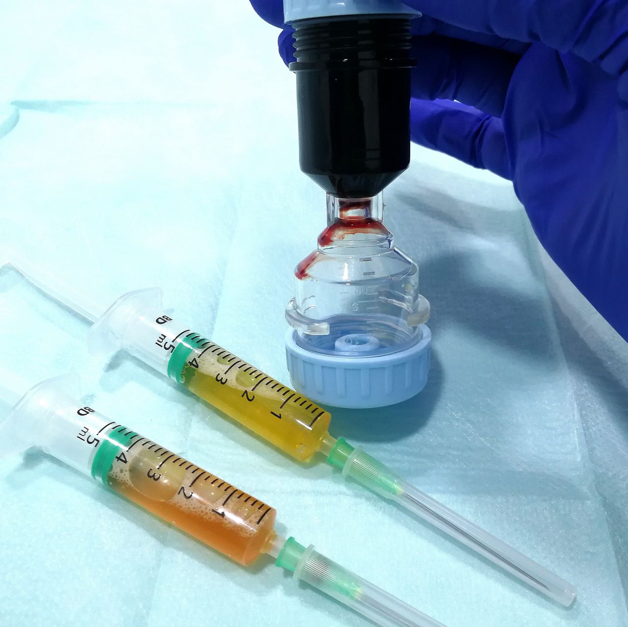 Ramiro Diego Abran-80