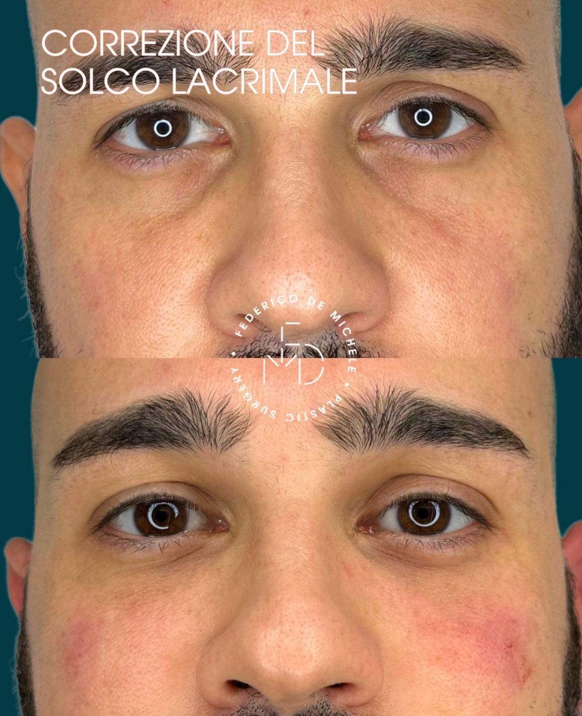 Federico De Michele-11